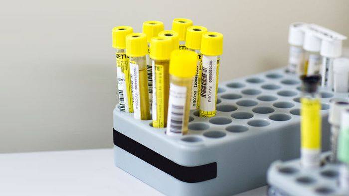 WADA допустила использование российской вакцины против COVID-19 для спортсменов.